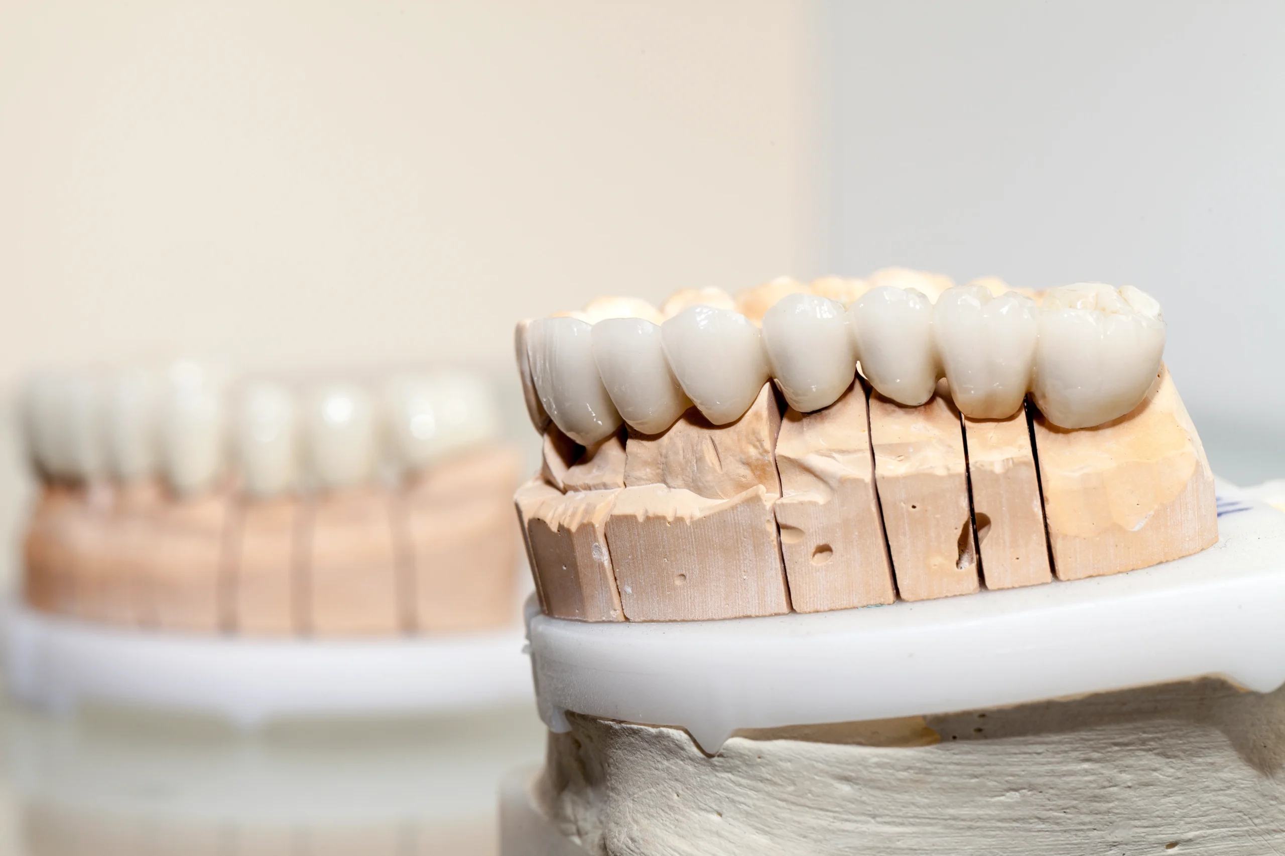 Dental Implant Restorations Prosper