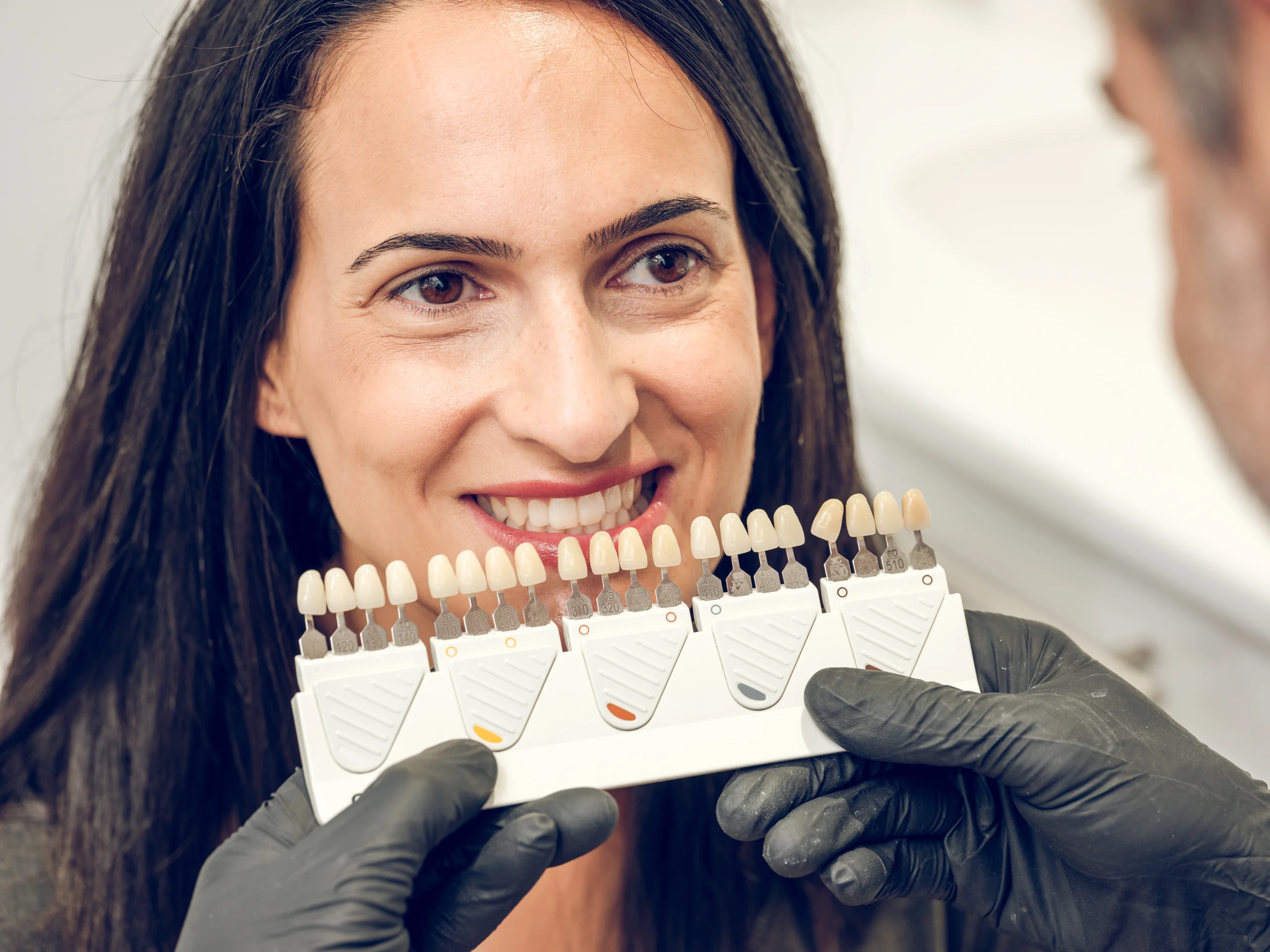 Dental Veneers Prosper