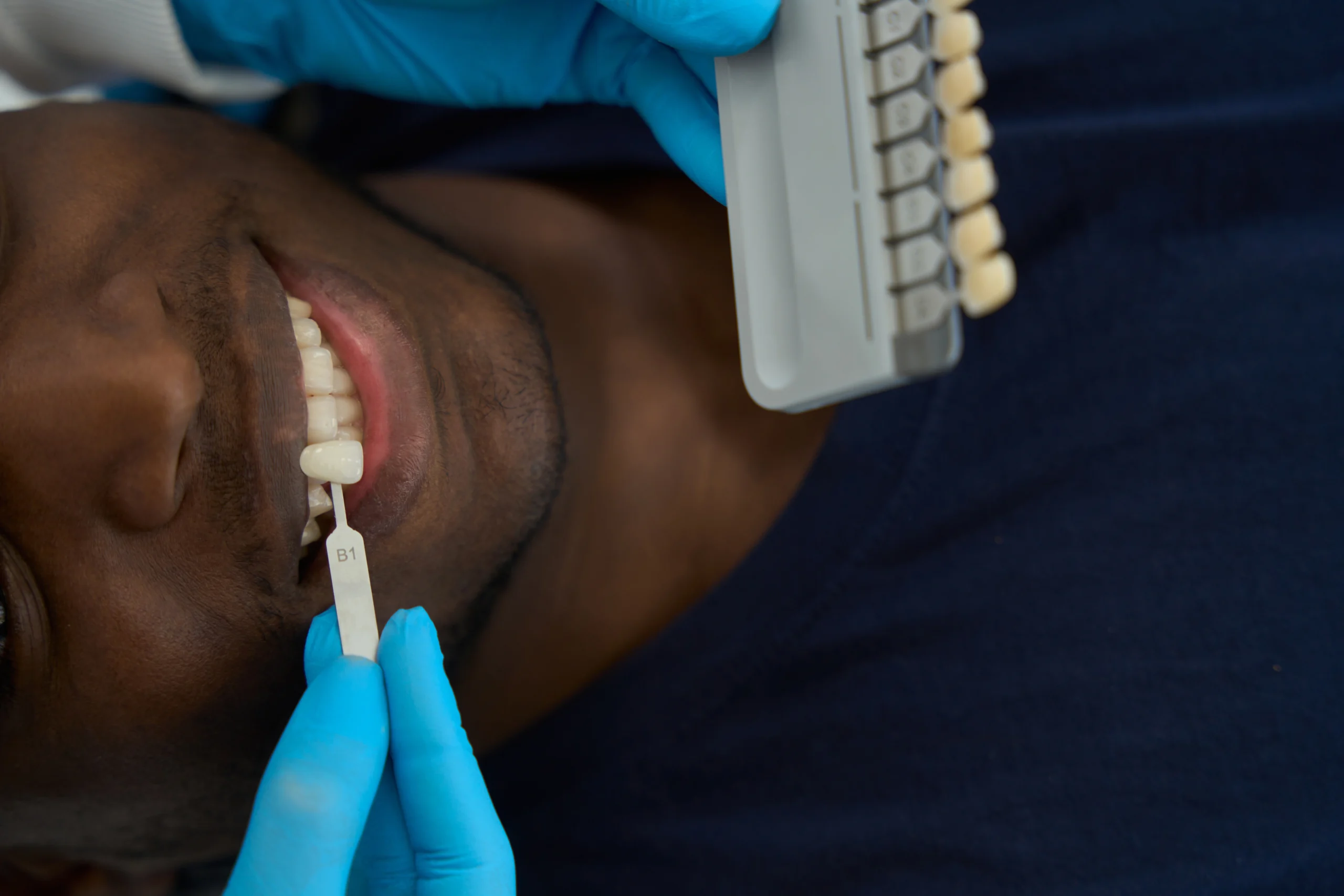 Dentures Prosper