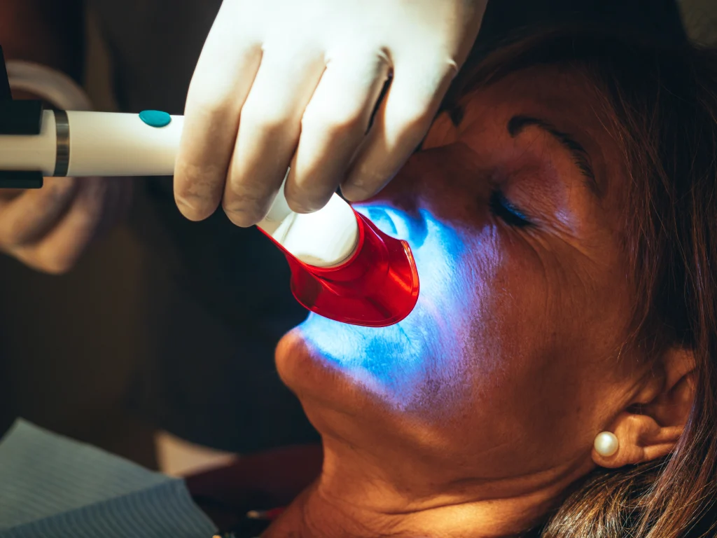 Teeth Whitening Prosper
