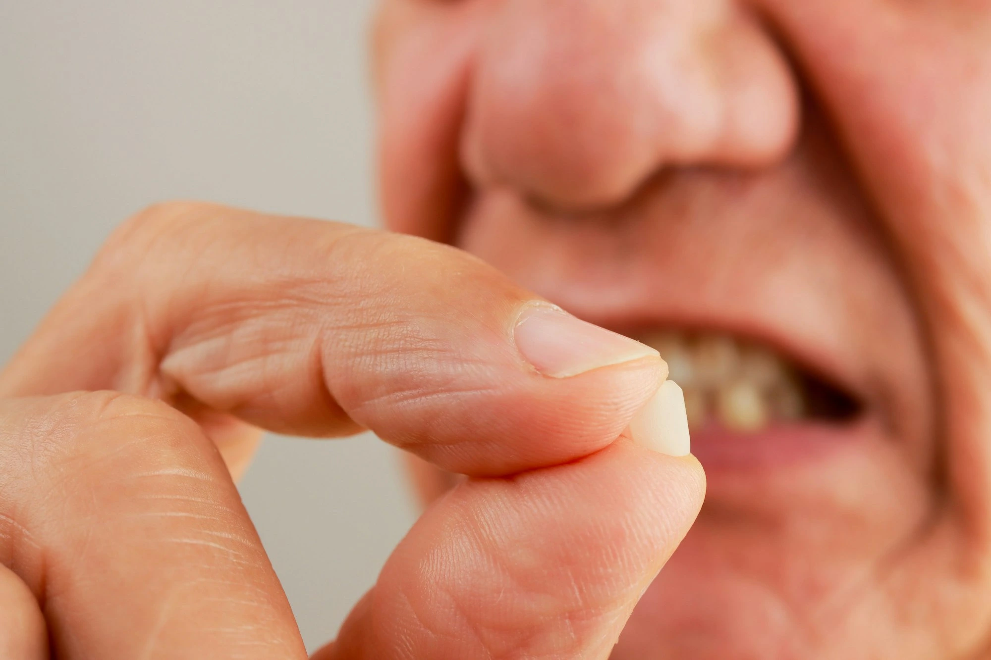 Man demonstrating his chipped tooth between his fingers.