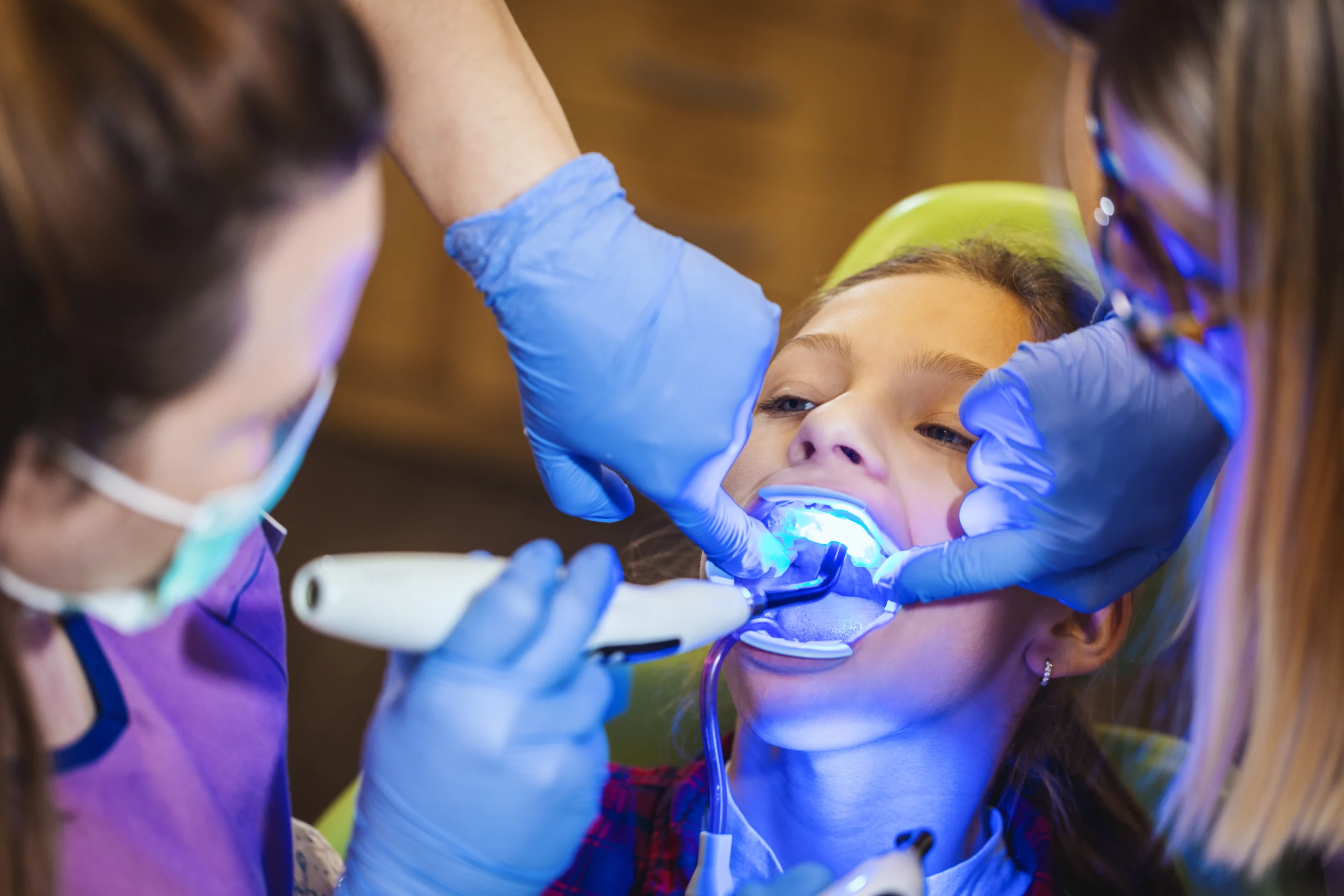 Teeth Whitening Prosper