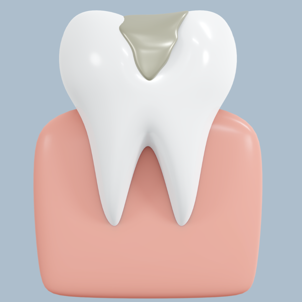 Dental Filling Prosper