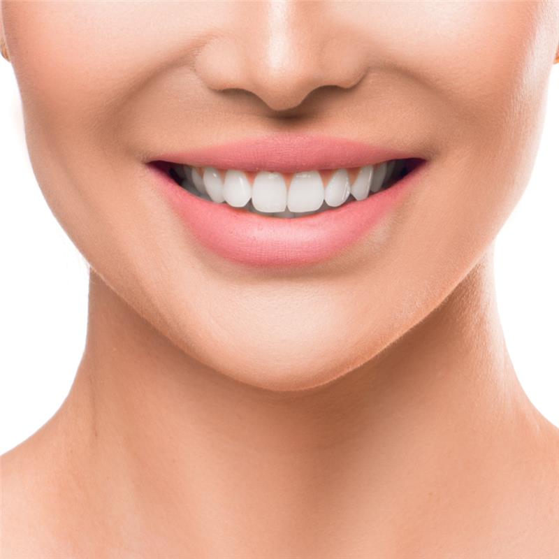 The Benefits of Teeth Whitening